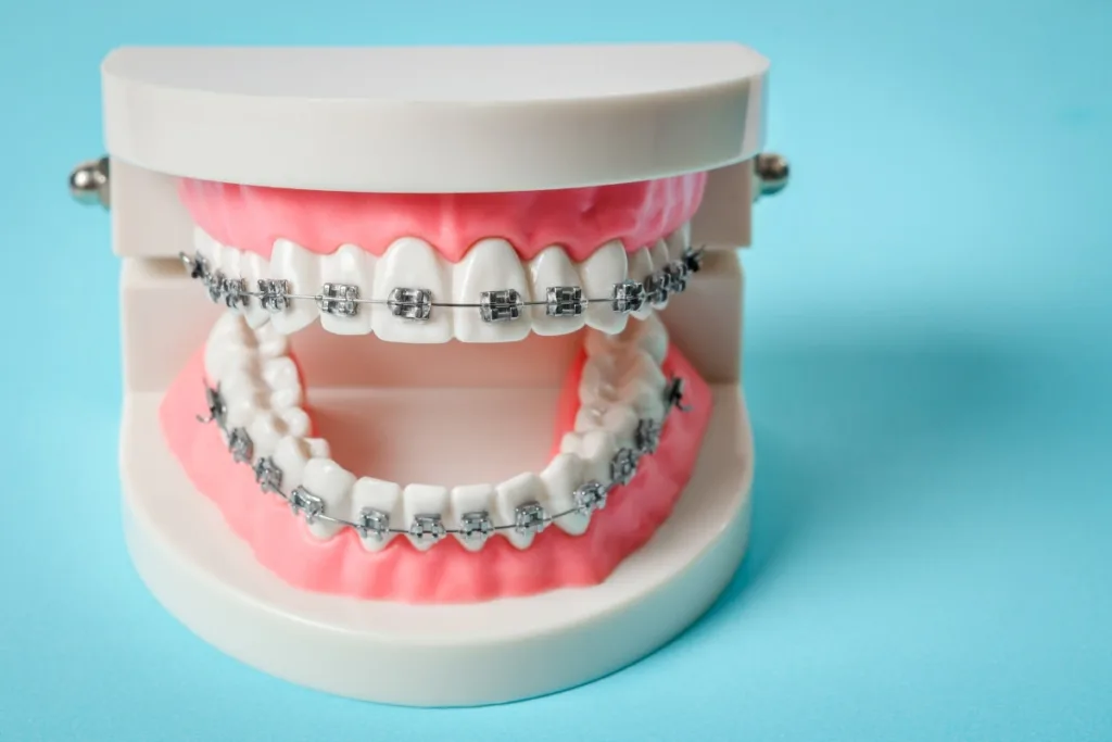 Treatments 70 Pune Dental Studio Baner