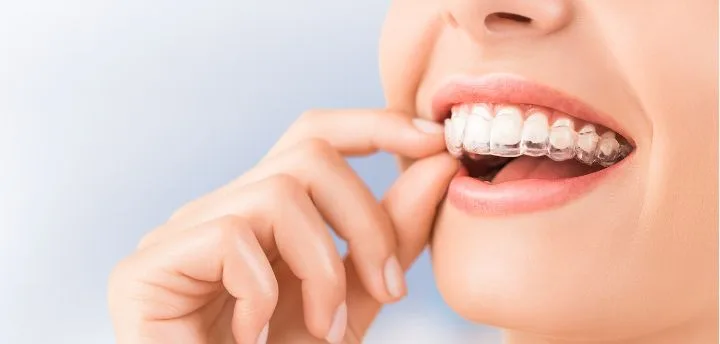 Home 10 Pune Dental Studio Baner