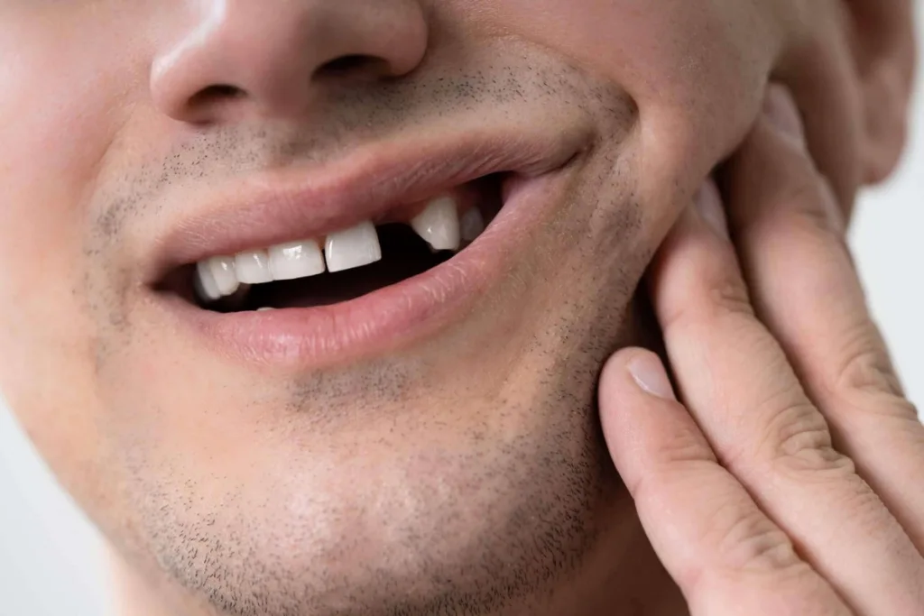 Missing Tooth Treatment 1 Pune Dental Studio Baner