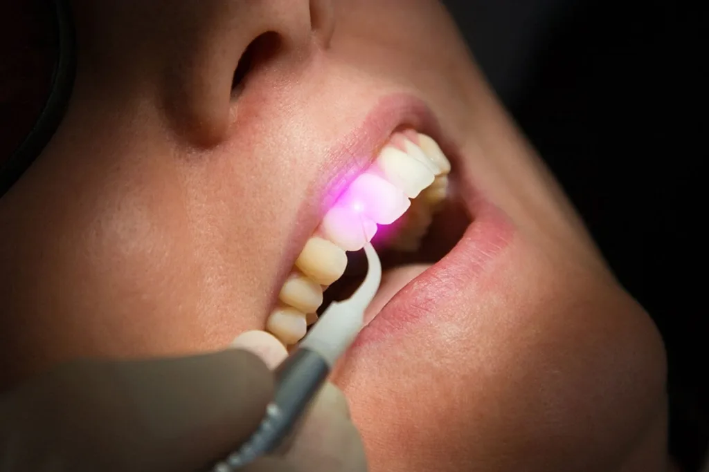 Painless Dental Treatment 1 Pune Dental Studio Baner
