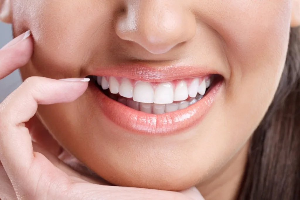 Smile Makeover 1 Pune Dental Studio Baner