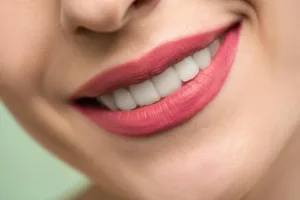 What You Need to Know About Teeth Whitening Treatments 1 Pune Dental Studio Baner